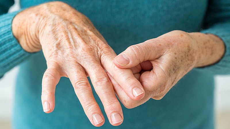 Причины и симптомы артрита пальцев рук. Медикаментозное лечение артрита пальцев рук. Народные средства для лечение артрита пальцев рук. Упражнения при артрите пальцев рук