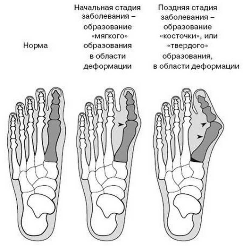 Схема пальцев ног