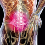 Причины и симптомы плечелопаточного артроза суставов. Лечение плечелопаточного артроза: препараты, средства, упражнения